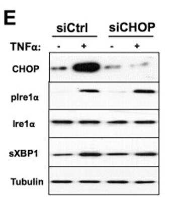 Detection of IRE1 alpha in Treated HAECs by Western Blot